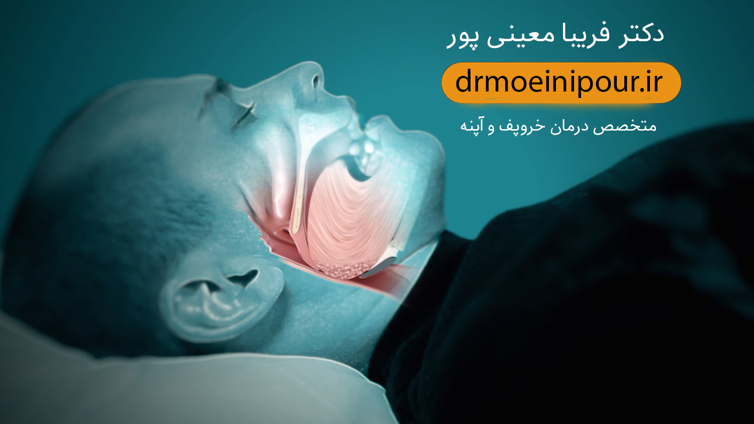 درمان خروپف Treating snoring